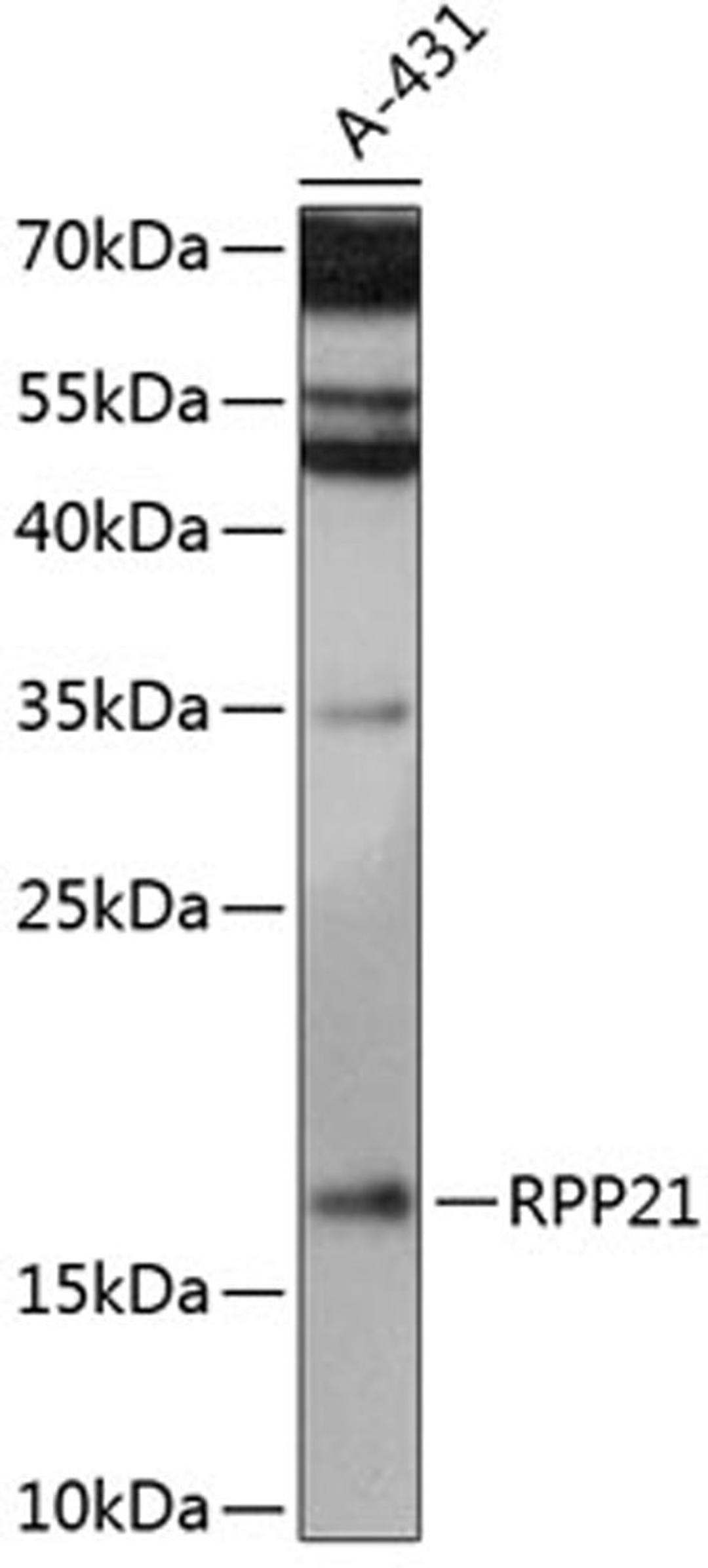 Western blot - RPP21 antibody (A14424)