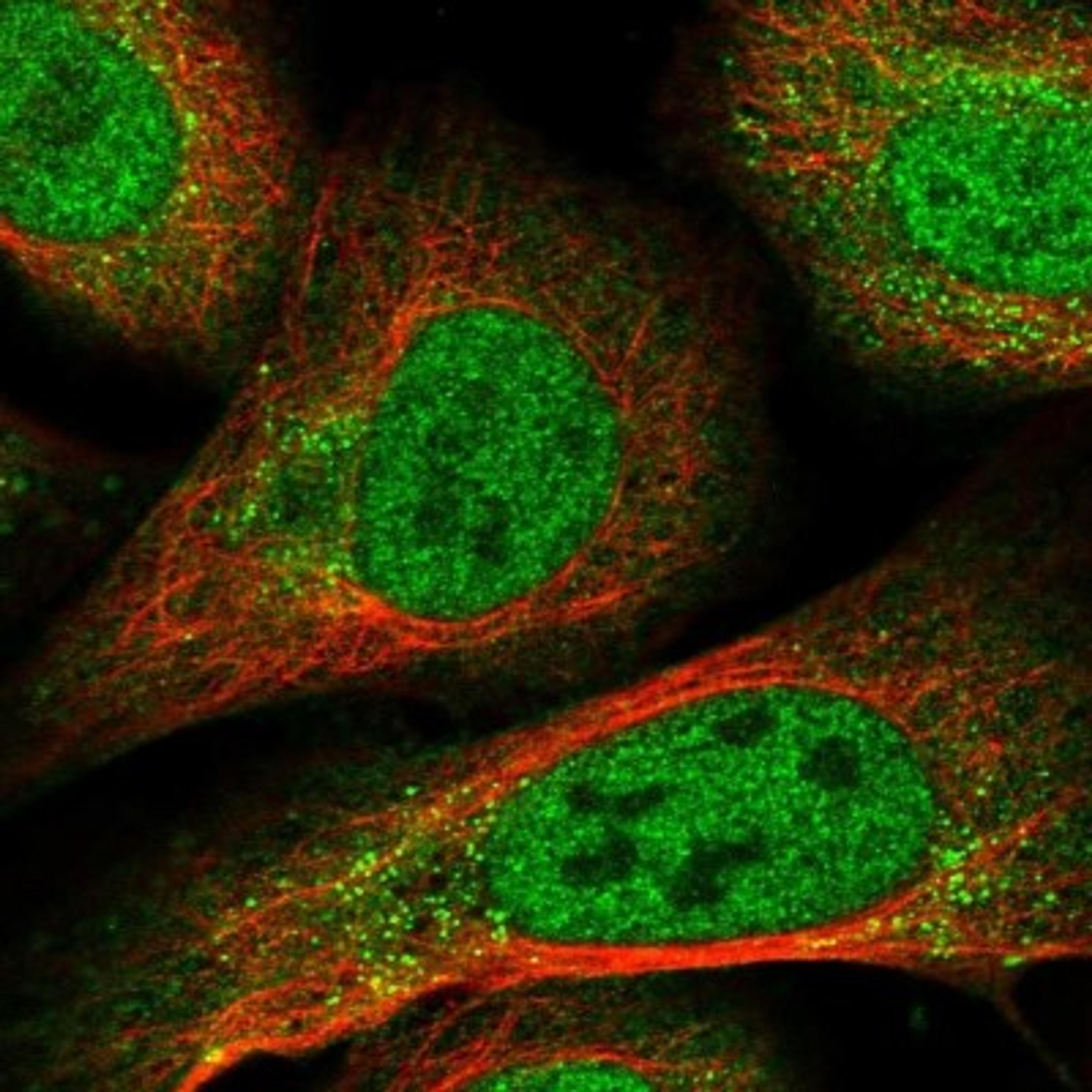 Immunocytochemistry/Immunofluorescence: RFX3 Antibody [NBP1-86301] - Immunofluorescent staining of human cell line U-2 OS shows positivity in nucleus but not nucleoli & vesicles.