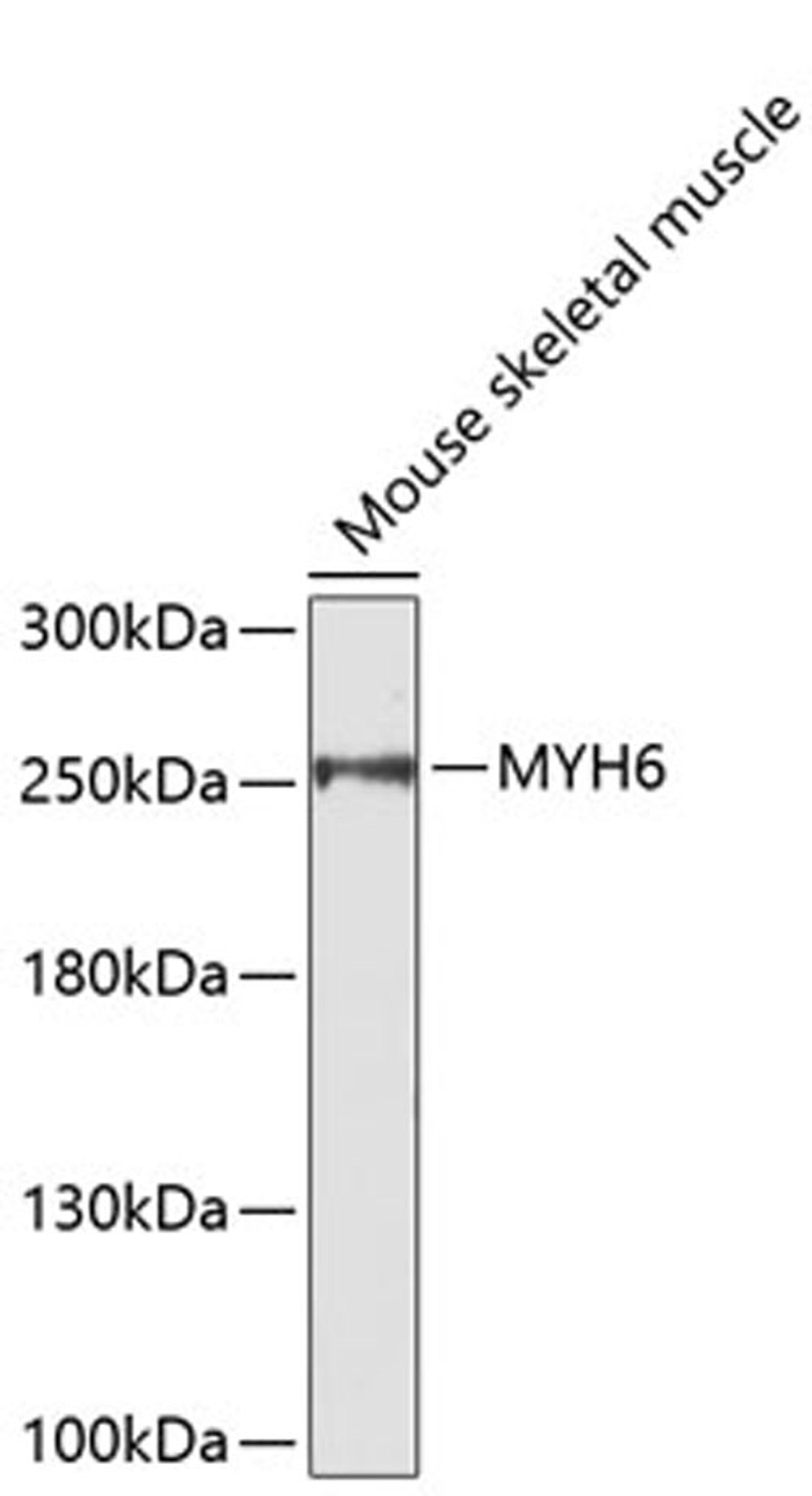 Western blot - MYH6 antibody (A9516)