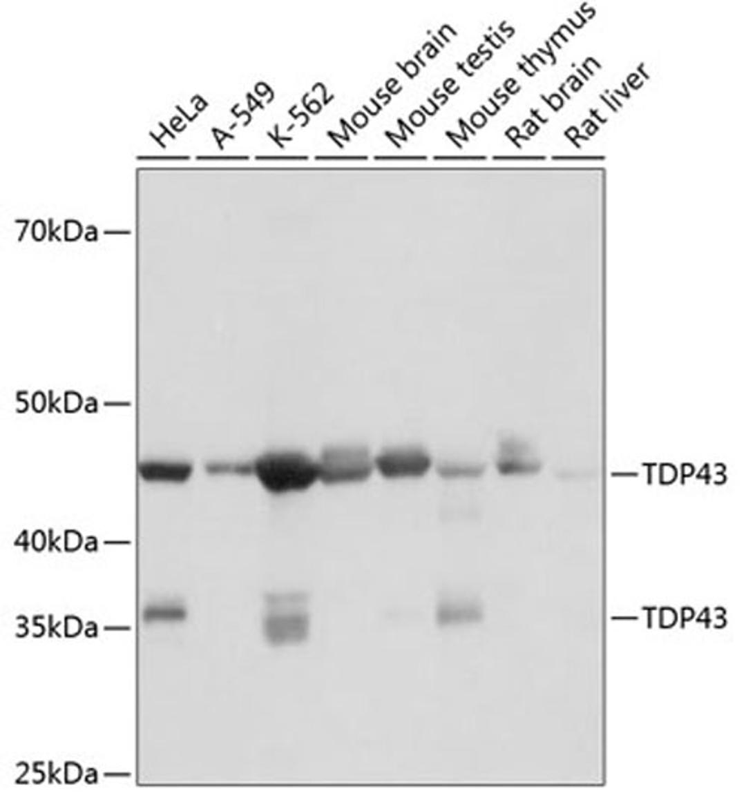 Western blot - TDP43 antibody (A19123)