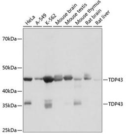 Western blot - TDP43 antibody (A19123)