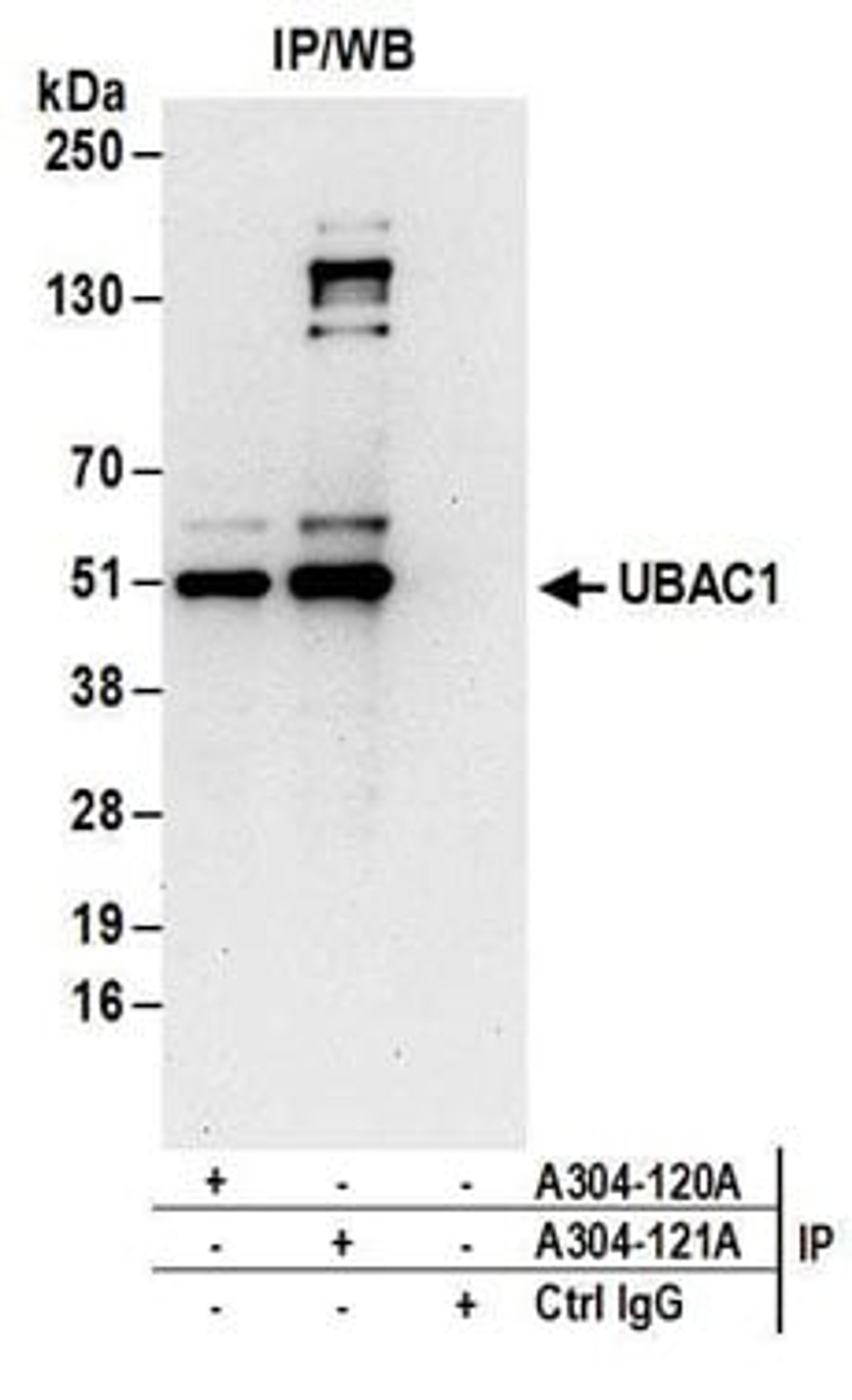 Detection of human UBAC1 by western blot of immunoprecipitates.