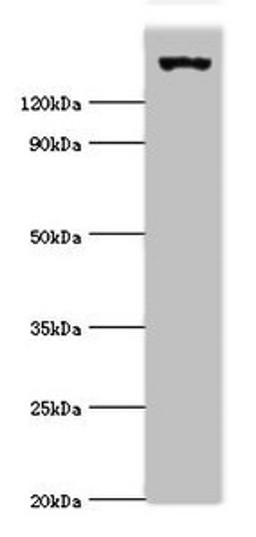 Western blot. All lanes: EIF2AK4 antibody at 2ug/ml + Mouse lung tissue. Secondary. Goat polyclonal to rabbit IgG at 1/10000 dilution. Predicted band size: 187, 184, 70 kDa. Observed band size: 187 kDa. 