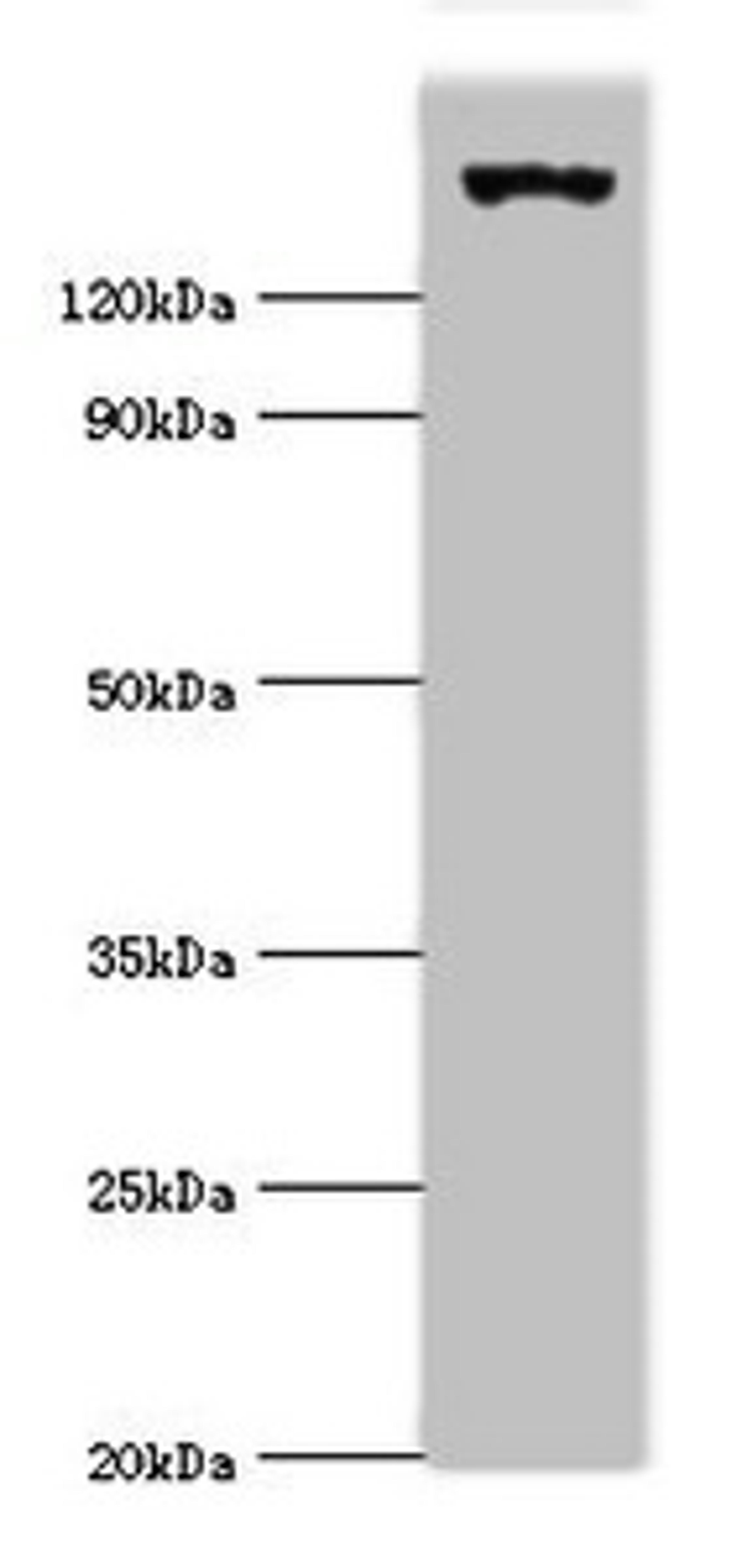 Western blot. All lanes: EIF2AK4 antibody at 2ug/ml + Mouse lung tissue. Secondary. Goat polyclonal to rabbit IgG at 1/10000 dilution. Predicted band size: 187, 184, 70 kDa. Observed band size: 187 kDa. 