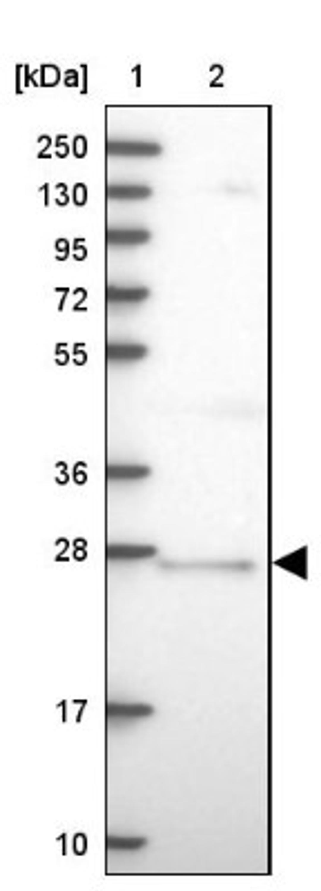 Western Blot: CNO Antibody [NBP1-91798] - Lane 1: Marker [kDa] 250, 130, 95, 72, 55, 36, 28, 17, 10<br/>Lane 2: Human cell line RT-4