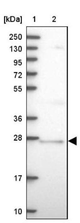 Western Blot: CNO Antibody [NBP1-91798] - Lane 1: Marker [kDa] 250, 130, 95, 72, 55, 36, 28, 17, 10<br/>Lane 2: Human cell line RT-4