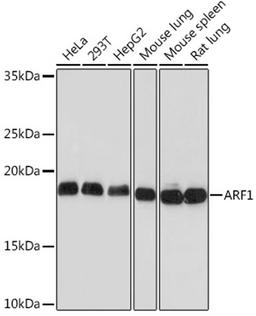 Western blot - ARF1 Rabbit mAb (A9195)