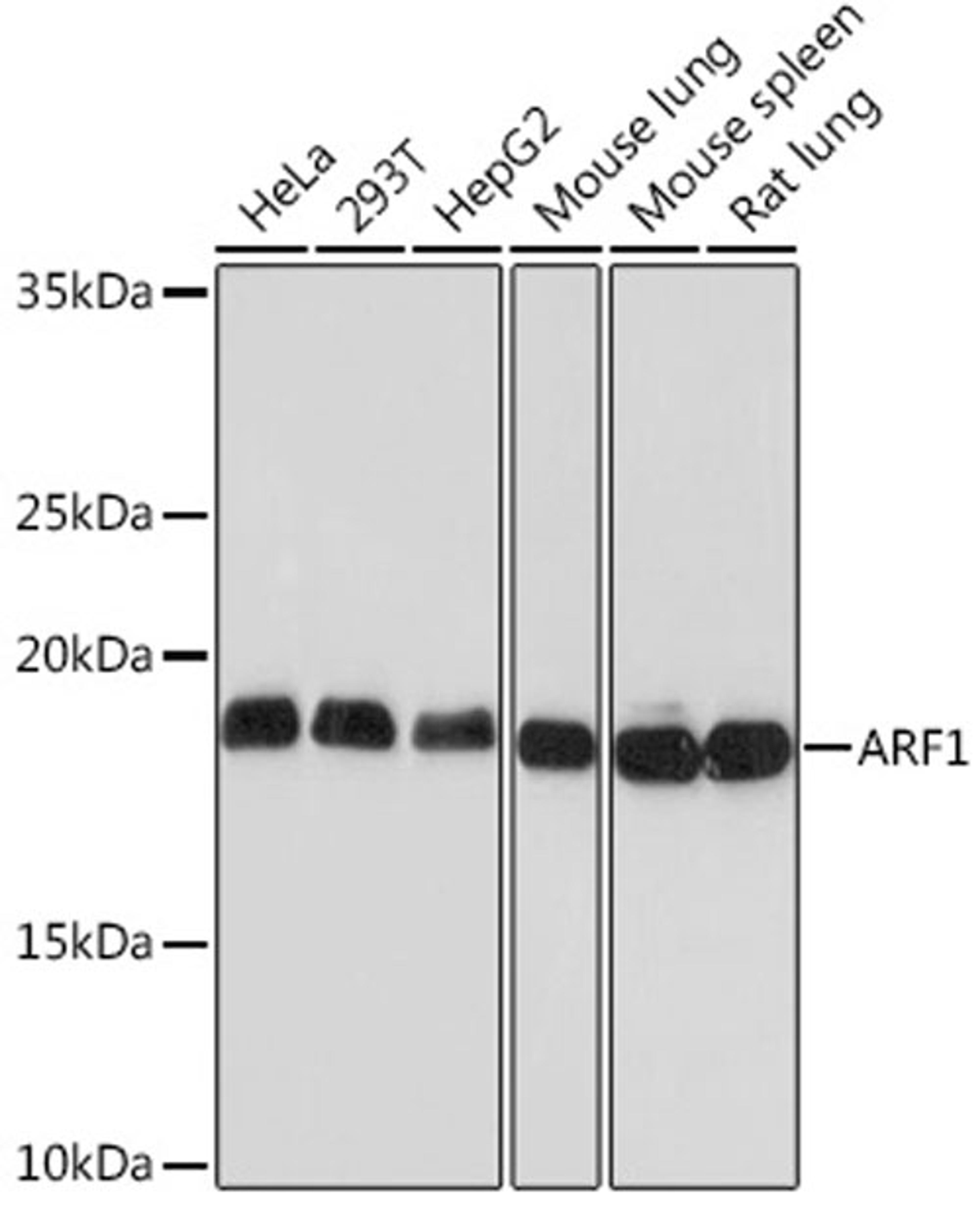 Western blot - ARF1 Rabbit mAb (A9195)