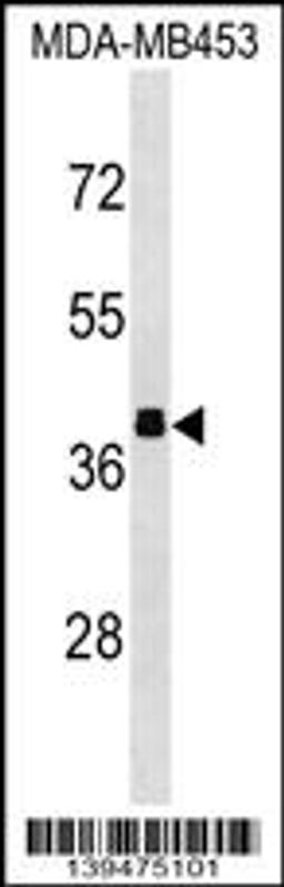 Western blot analysis in MDA-MB453 cell line lysates (35ug/lane).This demonstrates the ALDOB antibody detected the ALDOB protein (arrow).