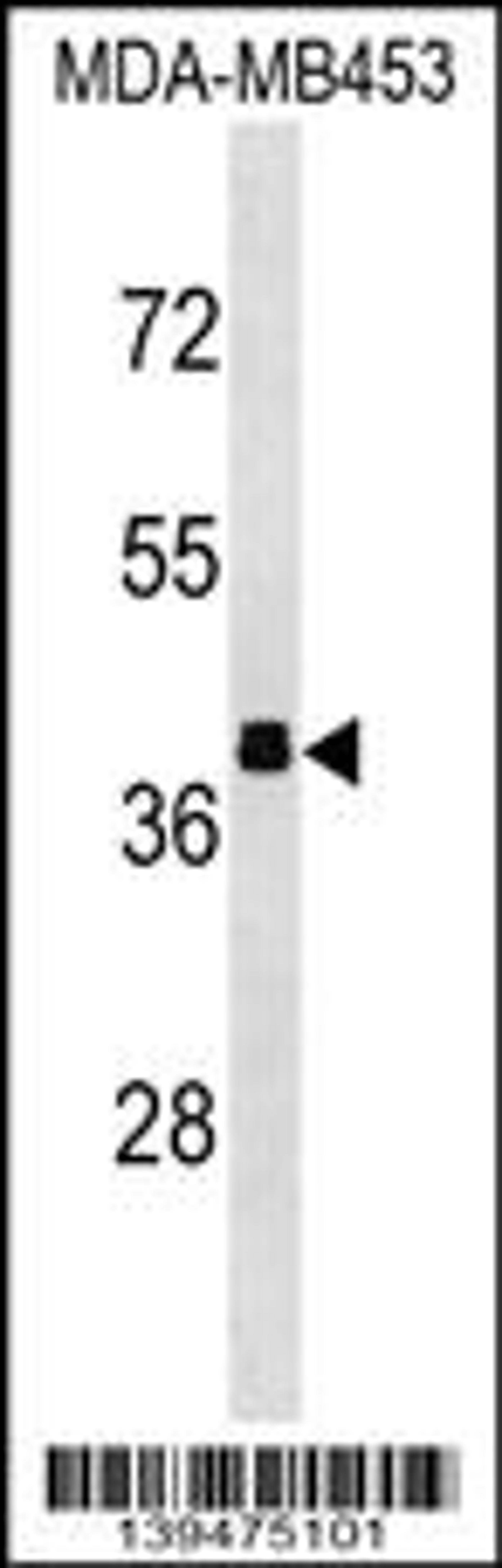 Western blot analysis in MDA-MB453 cell line lysates (35ug/lane).This demonstrates the ALDOB antibody detected the ALDOB protein (arrow).