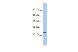 Antibody used in WB on Human Thymus at 0.2-1 ug/ml.