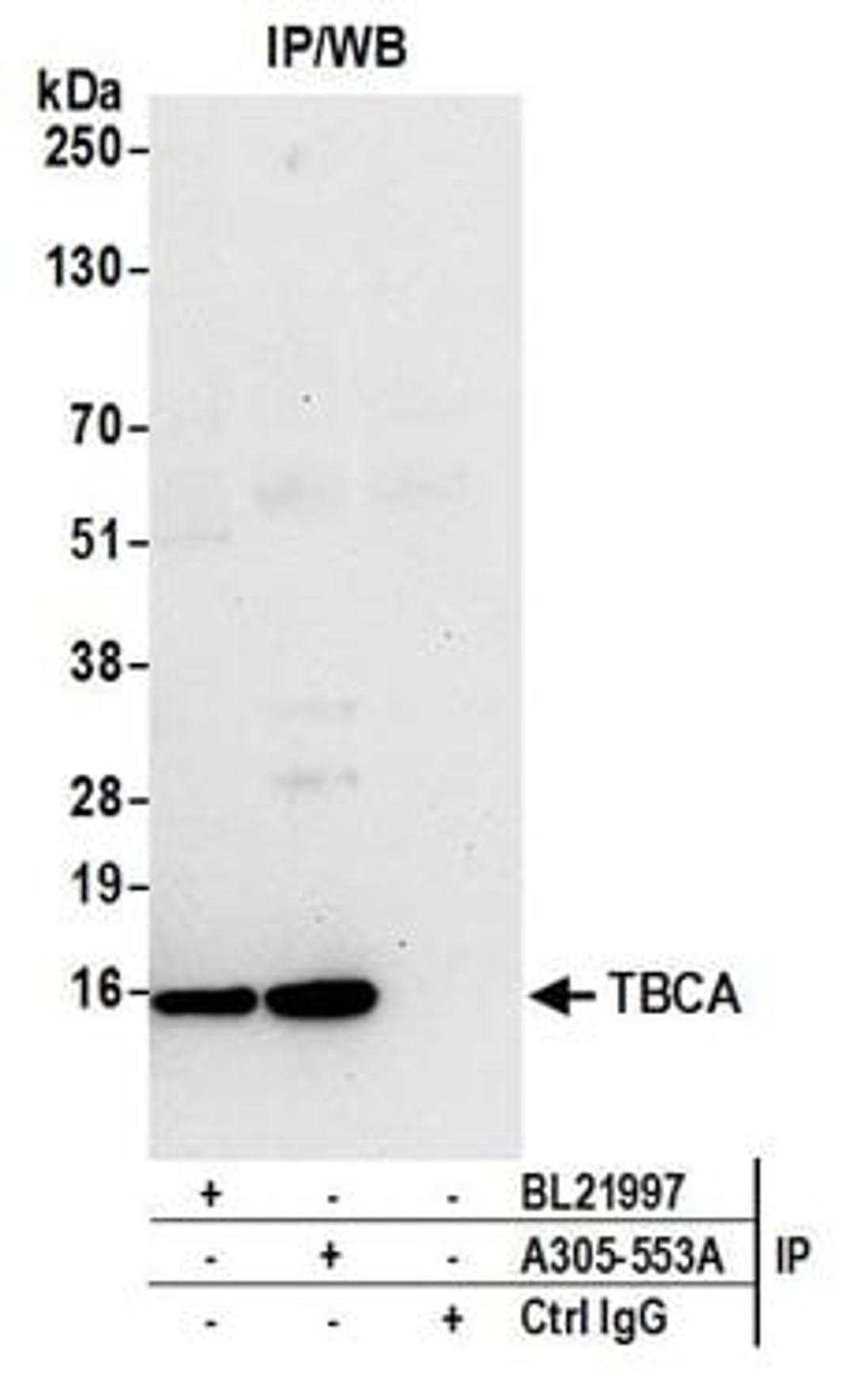 Detection of human TBCA by western blot of immunoprecipitates.