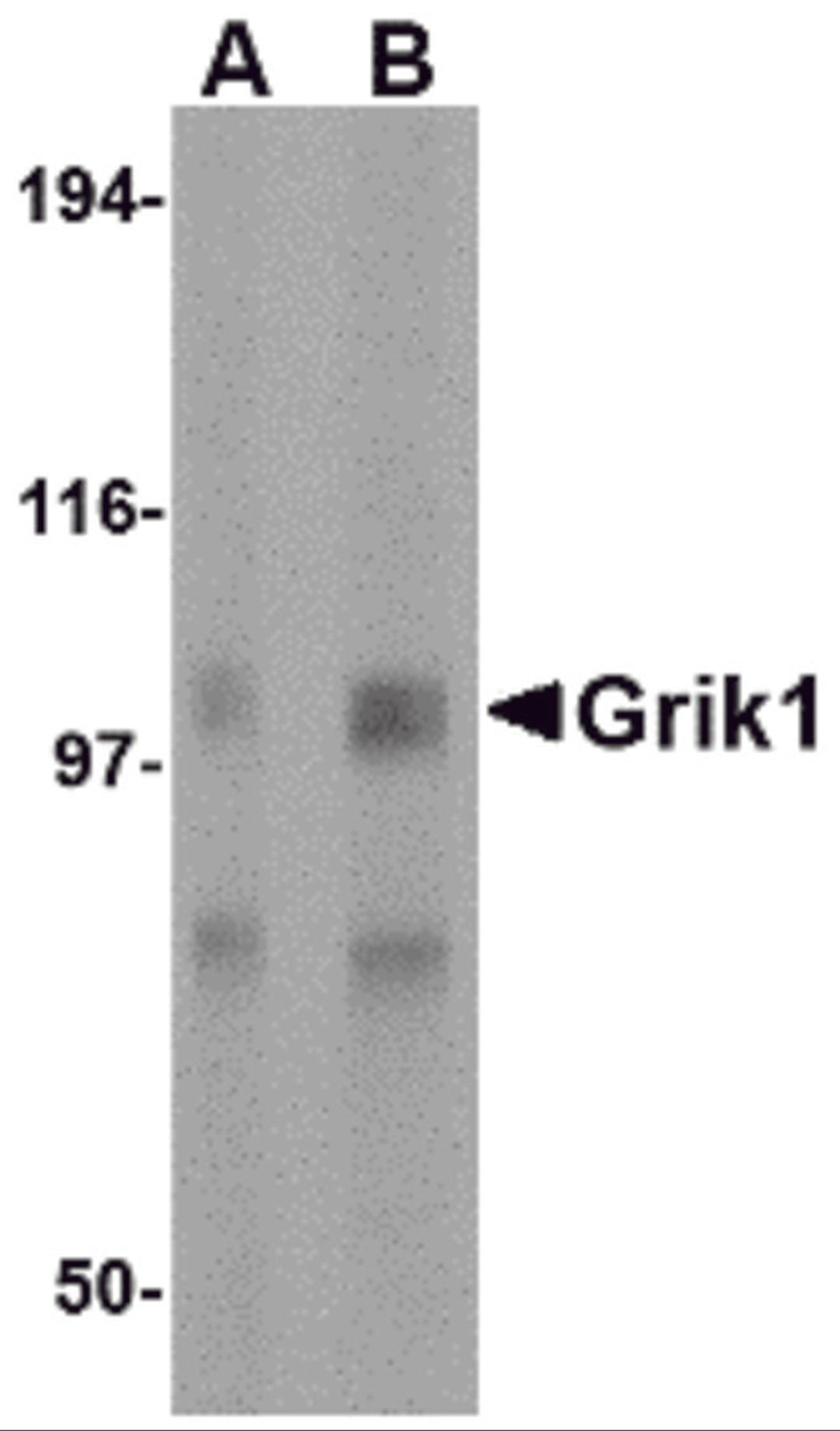 Western blot analysis of Grik1 in rat brain tissue lysate with Grik1 antibody at (A) 0.5 and (B) 1 &#956;g/mL.