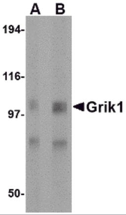 Western blot analysis of Grik1 in rat brain tissue lysate with Grik1 antibody at (A) 0.5 and (B) 1 μg/mL.