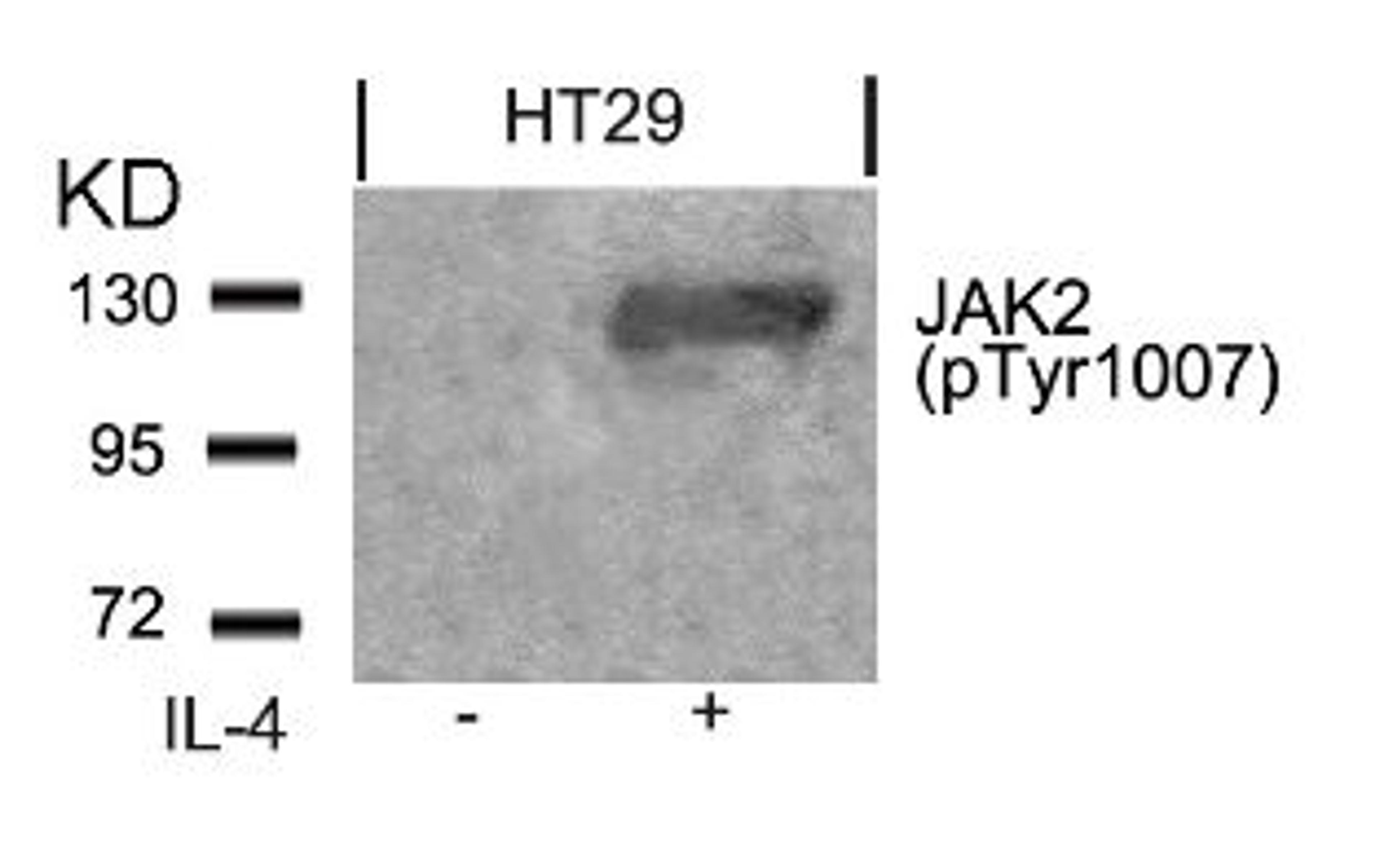 Western blot analysis of lysed extracts from HT29 cells untreated or treated with IL-4 using JAK2 (Phospho-Tyr1007).