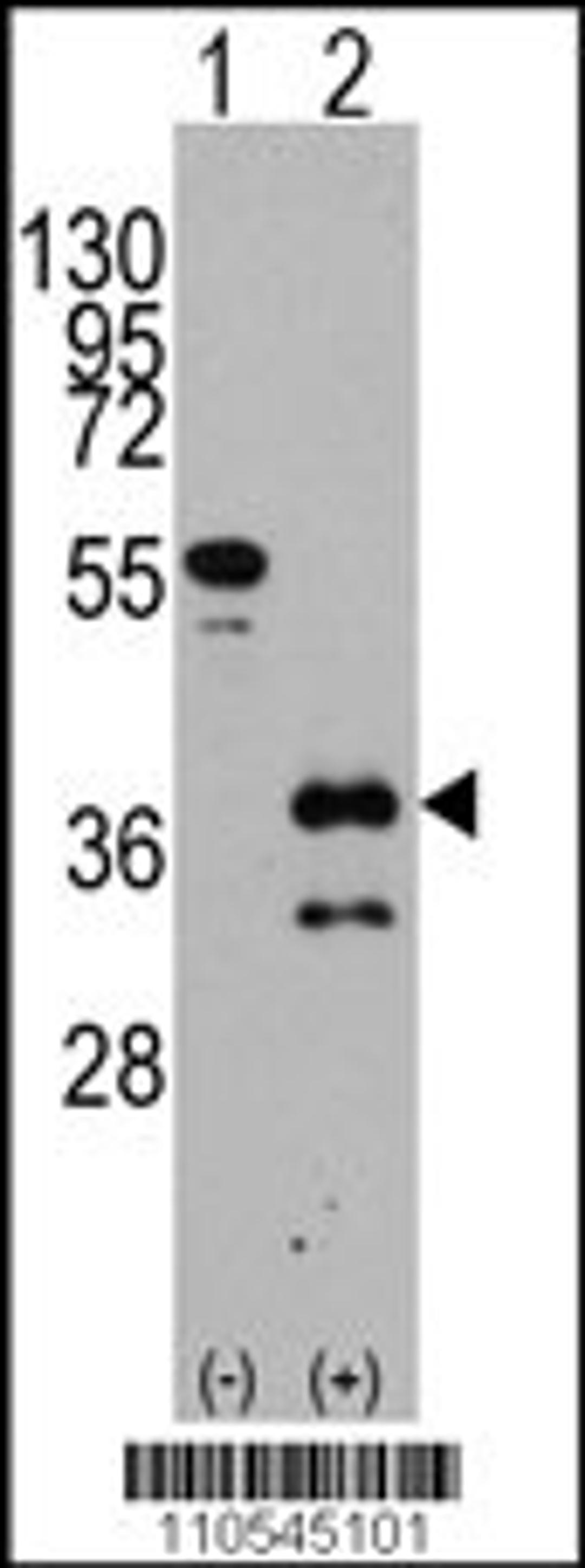 Western blot analysis of ZIC4 using rabbit polyclonal ZIC4 Antibody using 293 cell lysates (2 ug/lane) either nontransfected (Lane 1) or transiently transfected with the ZIC4 gene (Lane 2).