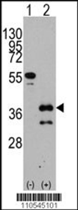 Western blot analysis of ZIC4 using rabbit polyclonal ZIC4 Antibody using 293 cell lysates (2 ug/lane) either nontransfected (Lane 1) or transiently transfected with the ZIC4 gene (Lane 2).