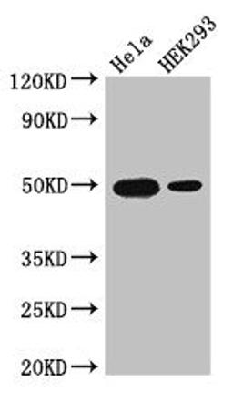 Western Blot. Positive WB detected in: Hela whole cell lysate, HEK293 whole cell lysate. All lanes: JUND antibody at 3µg/ml. Secondary. Goat polyclonal to rabbit IgG at 1/50000 dilution. Predicted band size: 36 kDa. Observed band size: 50 kDa