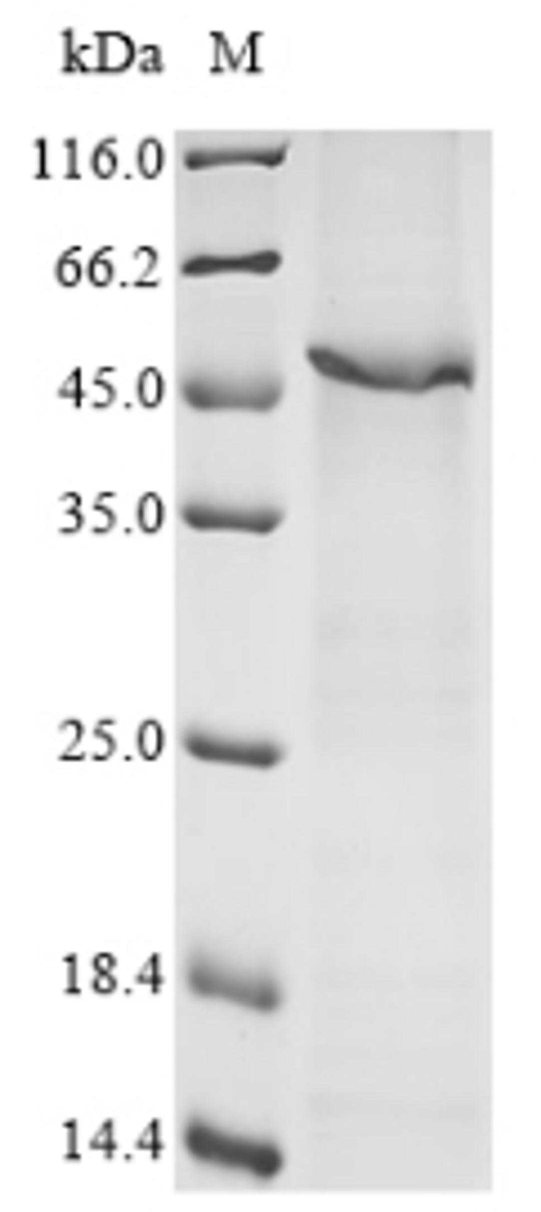 (Tris-Glycine gel) Discontinuous SDS-PAGE (reduced) with 5% enrichment gel and 15% separation gel.