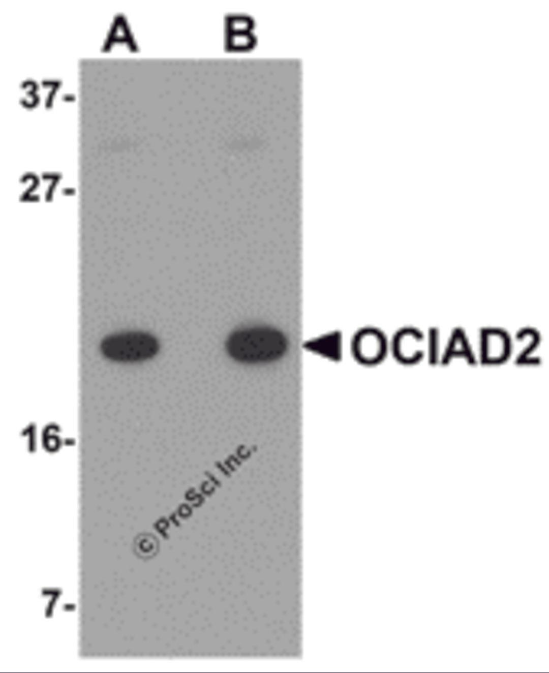 Western blot analysis of OCIAD2 in A549 cell lysate with OCIAD2 antibody at (A) 0.5 and (B) 1 μg/mL.