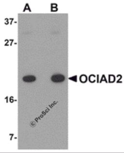 Western blot analysis of OCIAD2 in A549 cell lysate with OCIAD2 antibody at (A) 0.5 and (B) 1 μg/mL.
