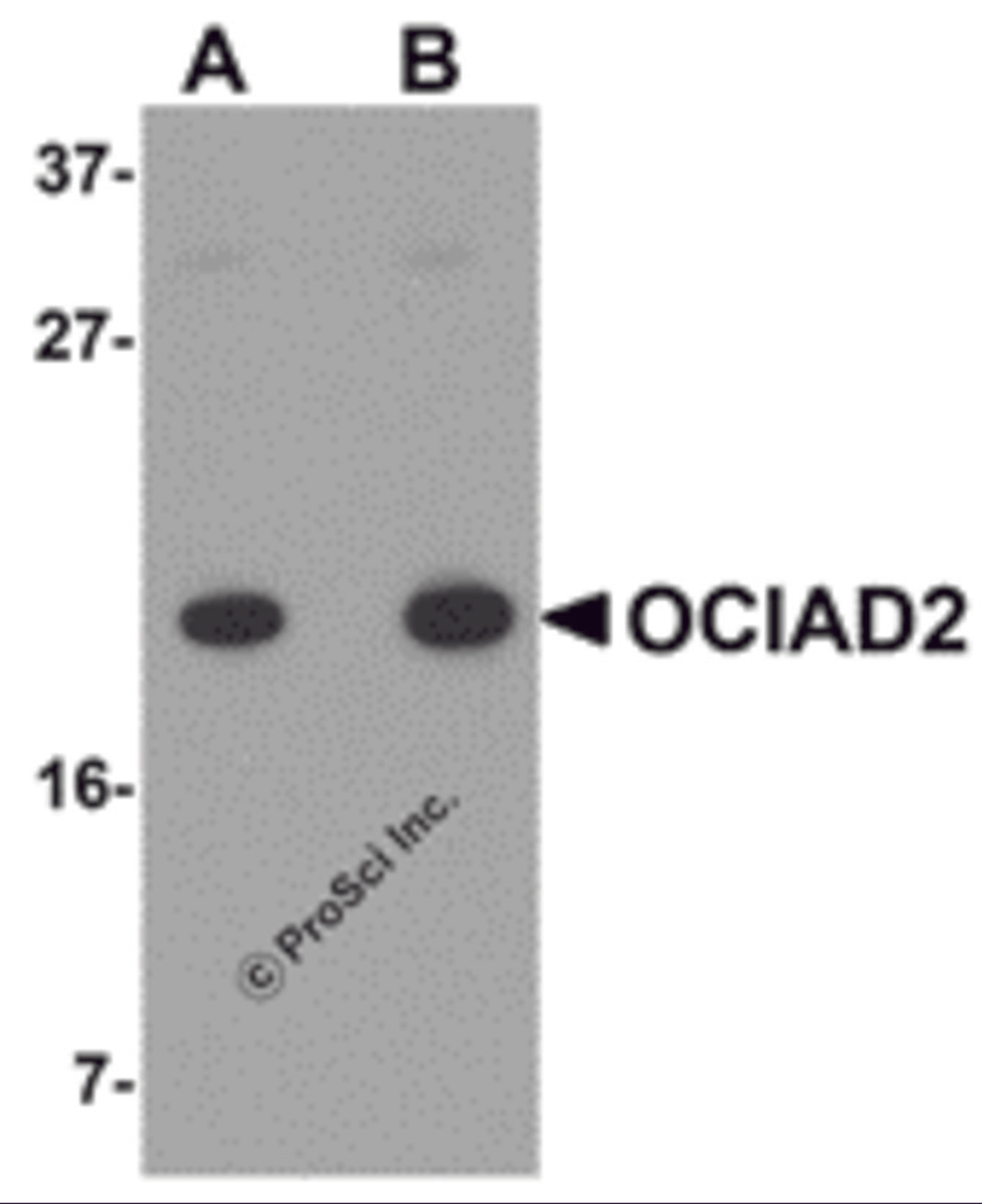 Western blot analysis of OCIAD2 in A549 cell lysate with OCIAD2 antibody at (A) 0.5 and (B) 1 μg/mL.