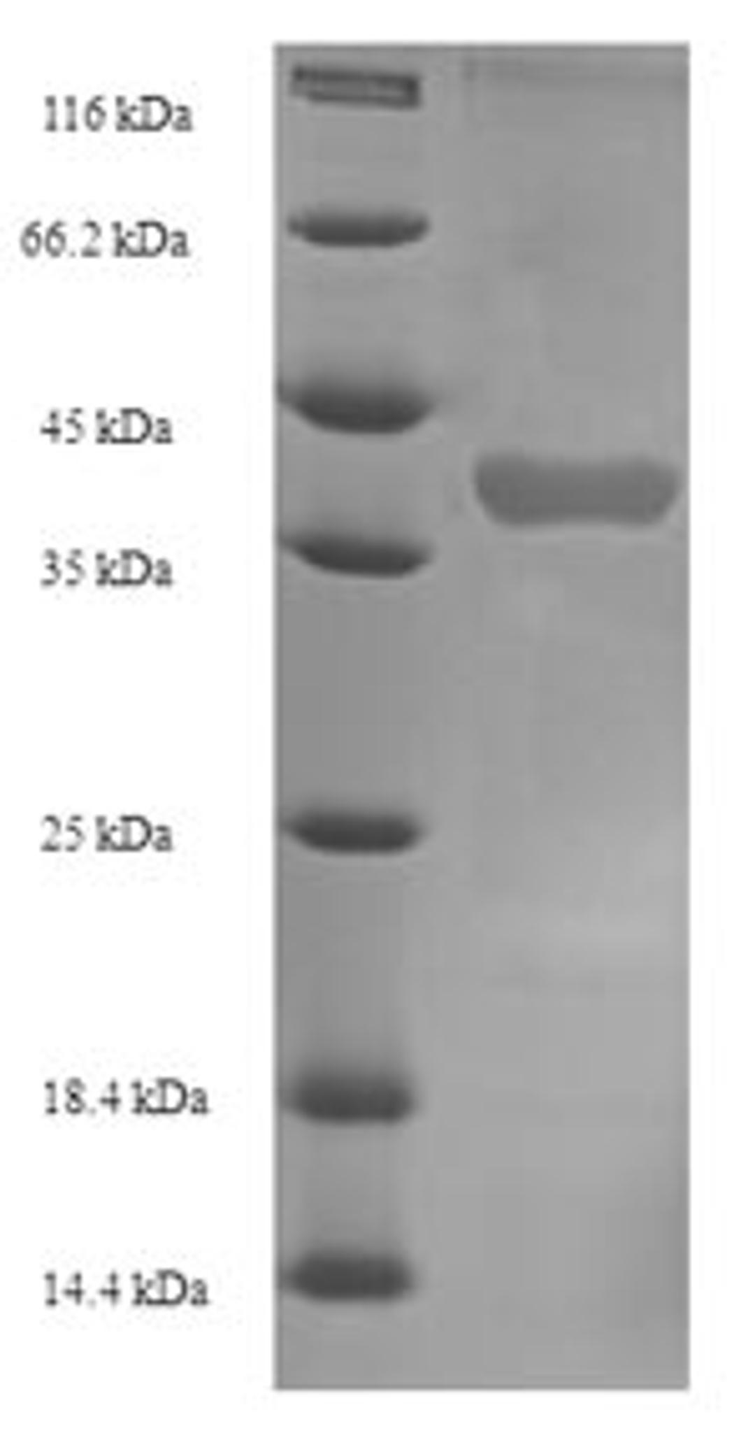 (Tris-Glycine gel) Discontinuous SDS-PAGE (reduced) with 5% enrichment gel and 15% separation gel.