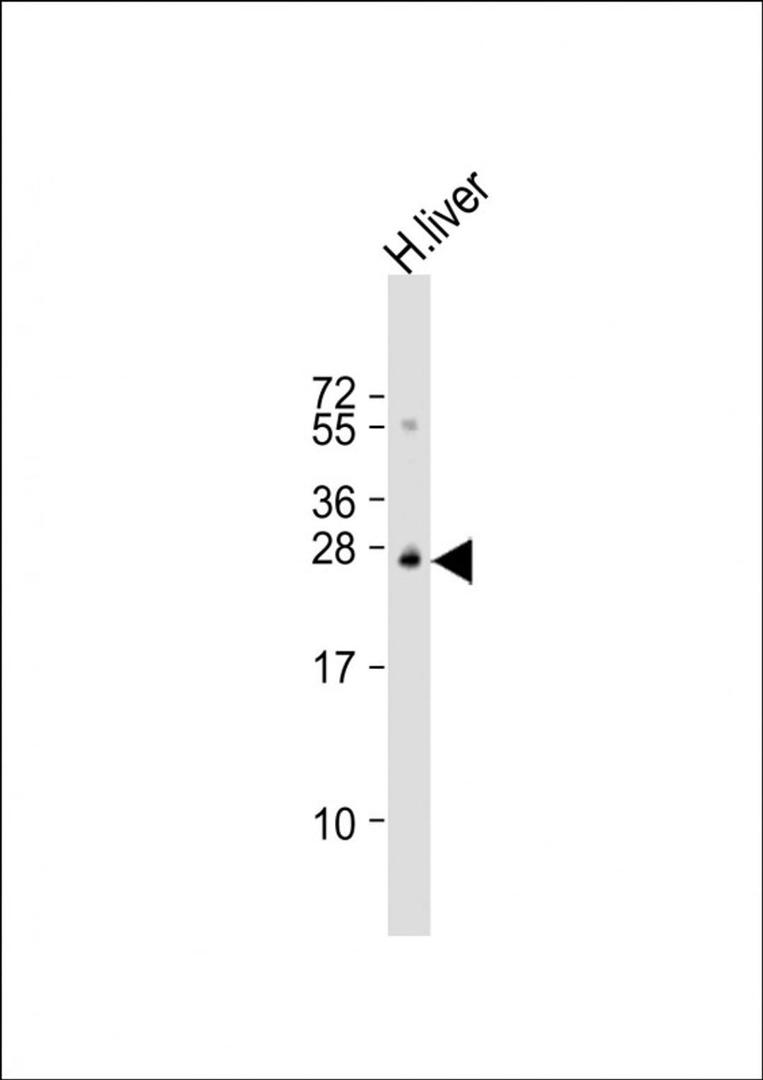 Western Blot at 1:1000 dilution + human liver lysate Lysates/proteins at 20 ug per lane.