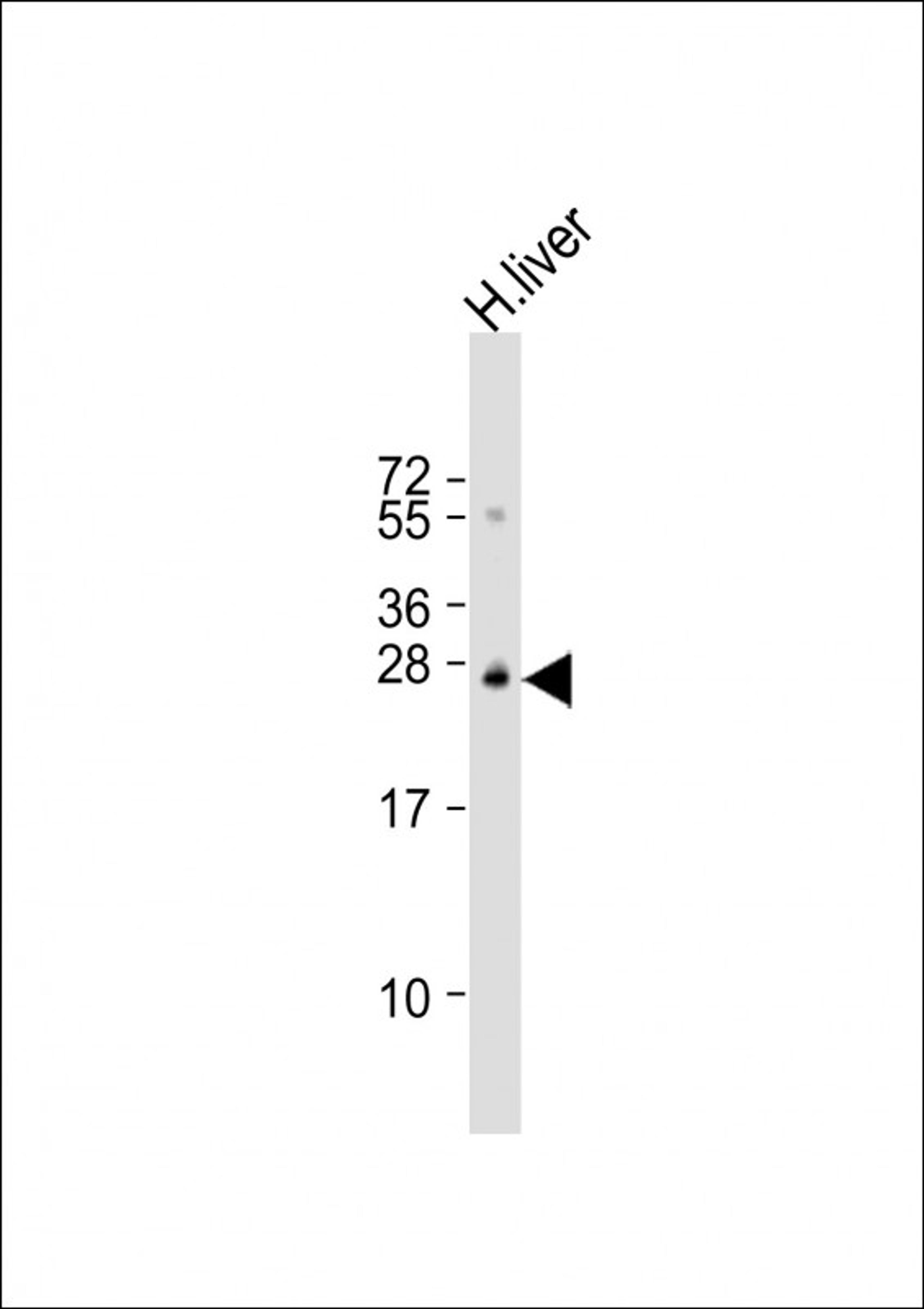 Western Blot at 1:1000 dilution + human liver lysate Lysates/proteins at 20 ug per lane.