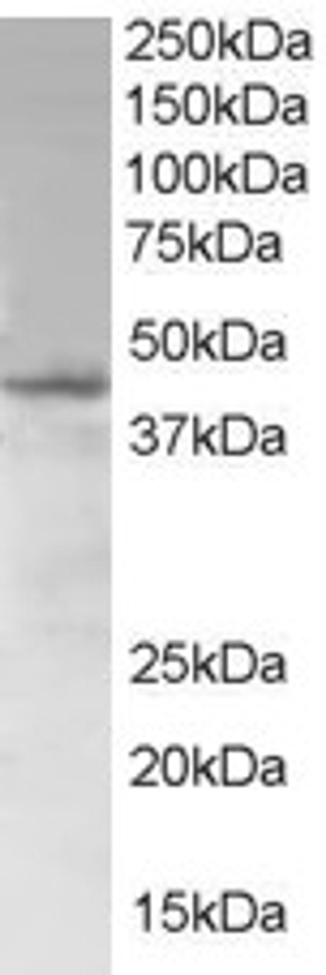 46-334 (1ug/ml) staining of Jurkat lysate (35ug protein in RIPA buffer). Primary incubation was 1 hour. Detected by chemiluminescence.