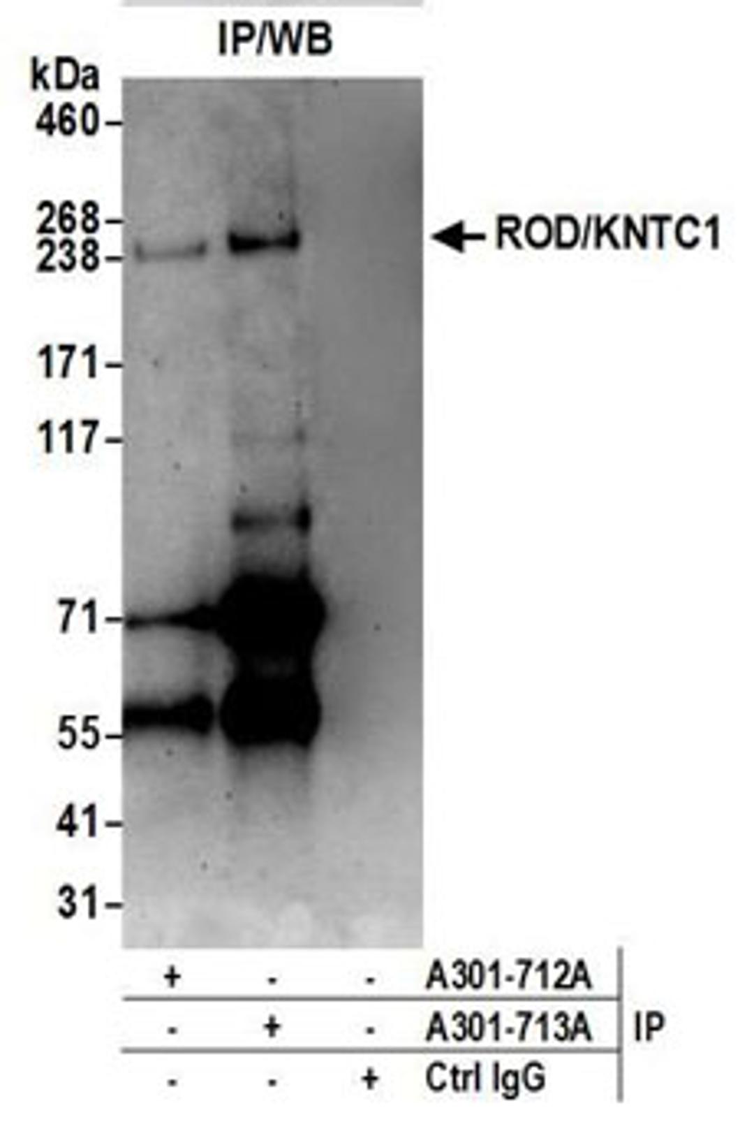 Detection of human ROD/KNTC1 by western blot of immunoprecipitates.