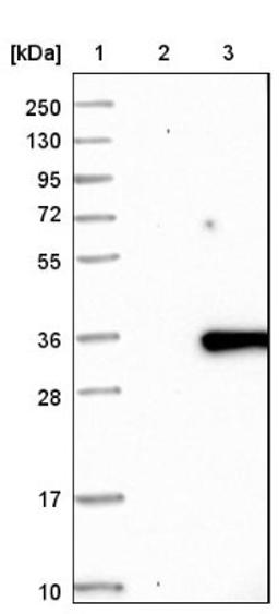 Immunohistochemistry: FAM167A Antibody [NBP1-91237] - Lane 1: Marker [kDa] 250, 130, 95, 72, 55, 36, 28, 17, 10<br/>Lane 2: Negative control (vector only transfected HEK293T lysate)<br/>Lane 3: Over-expression lysate (Co-expressed with a C-terminal myc-DDK tag (~3.1 kDa) in mammalian HEK293T cells, LY409297)