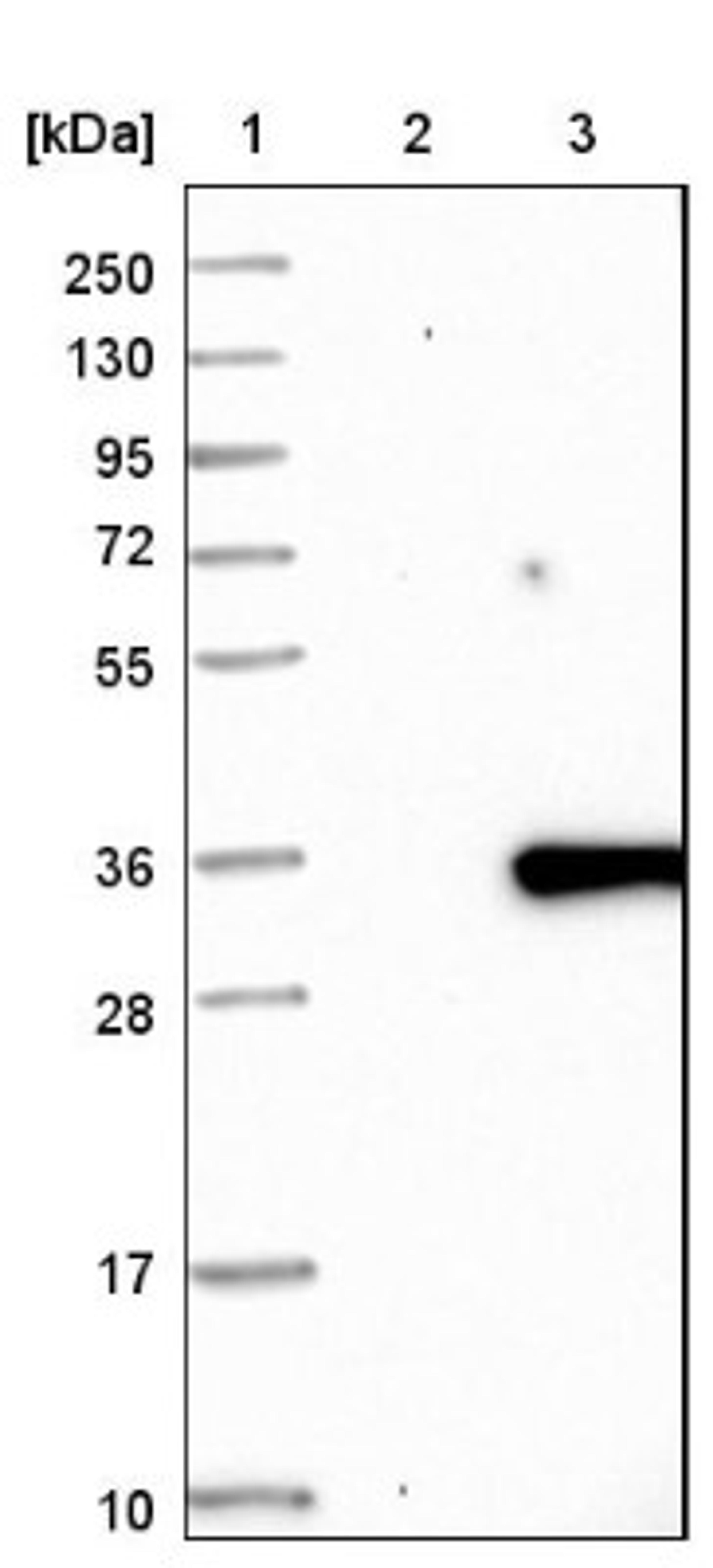 Immunohistochemistry: FAM167A Antibody [NBP1-91237] - Lane 1: Marker [kDa] 250, 130, 95, 72, 55, 36, 28, 17, 10<br/>Lane 2: Negative control (vector only transfected HEK293T lysate)<br/>Lane 3: Over-expression lysate (Co-expressed with a C-terminal myc-DDK tag (~3.1 kDa) in mammalian HEK293T cells, LY409297)