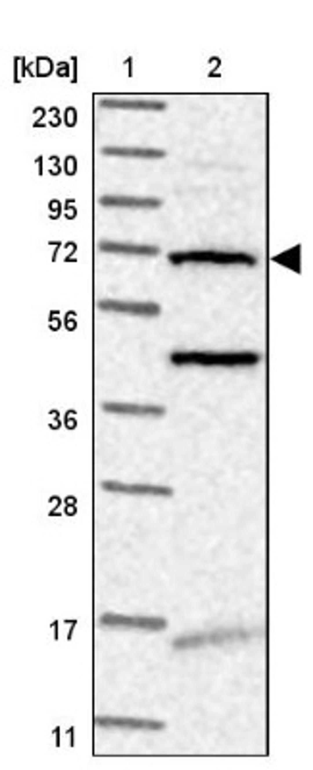 Western Blot: TMEM87B Antibody [NBP1-94006] - Lane 1: Marker [kDa] 230, 130, 95, 72, 56, 36, 28, 17, 11<br/>Lane 2: Human cell line RT-4