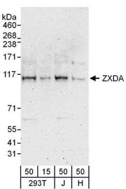 Detection of human ZXDA by western blot.