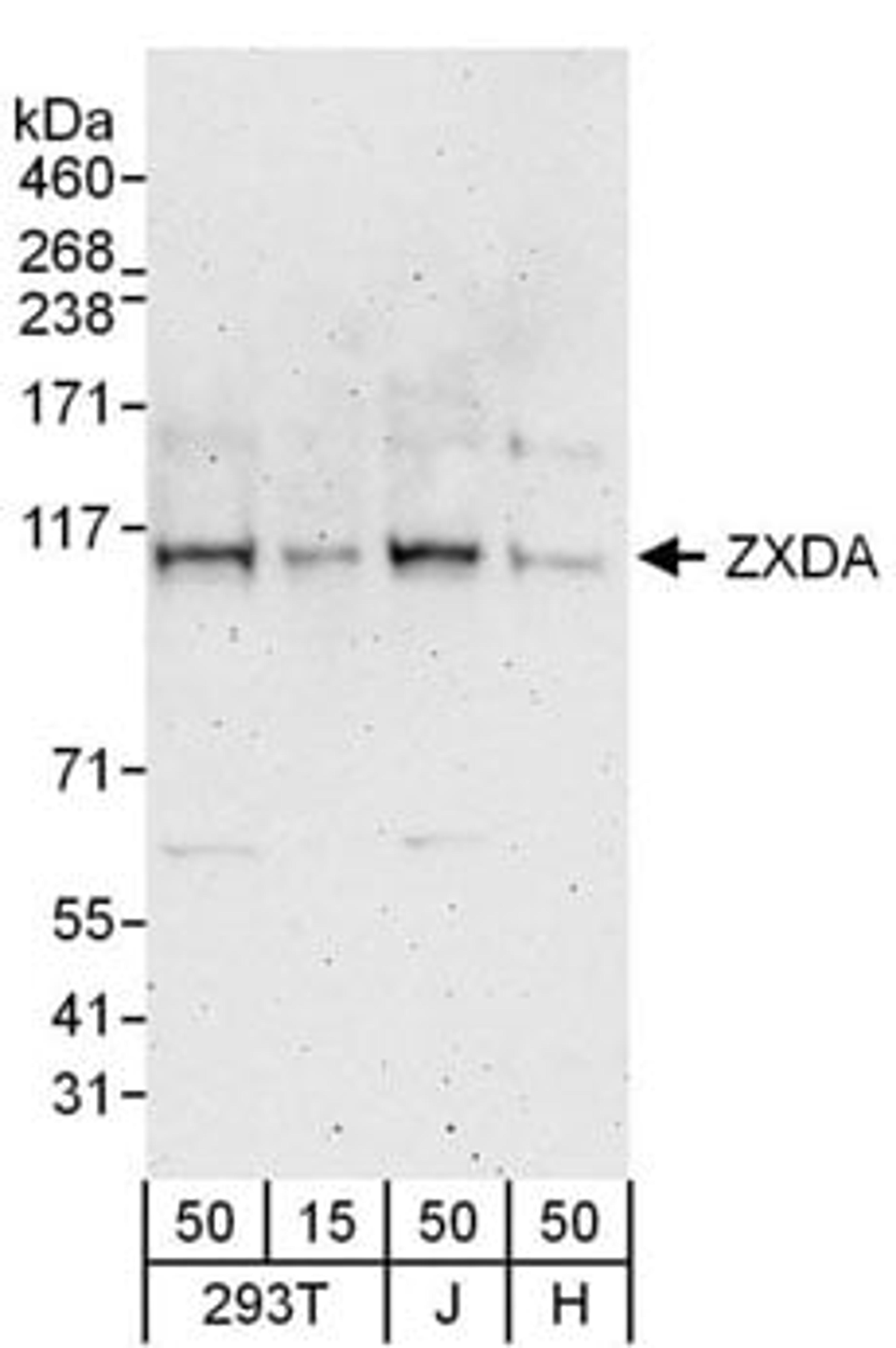 Detection of human ZXDA by western blot.