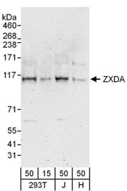 Detection of human ZXDA by western blot.