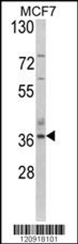 Western blot analysis of ASPA Antibody in MCF7 cell line lysates (35ug/lane)