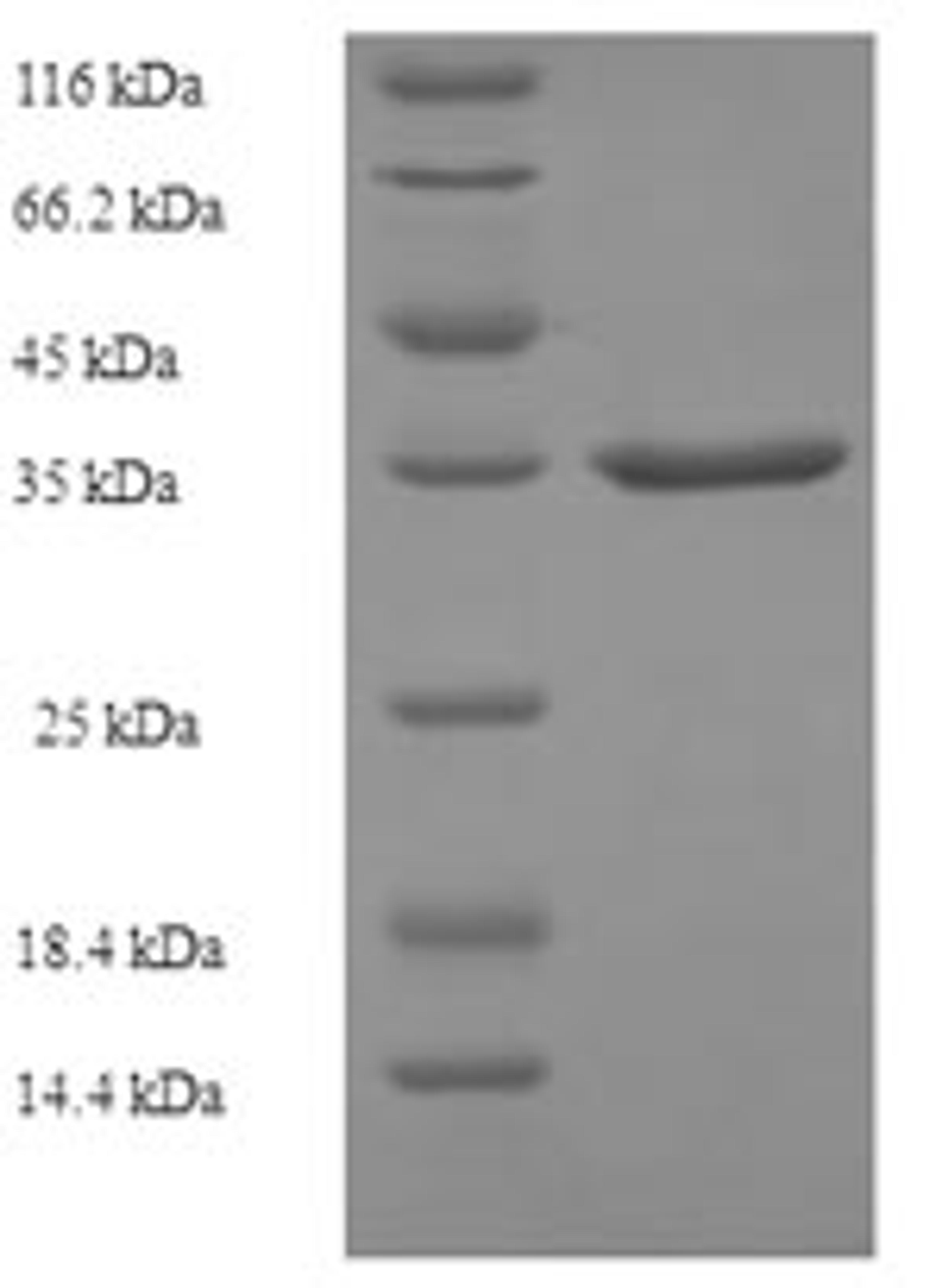(Tris-Glycine gel) Discontinuous SDS-PAGE (reduced) with 5% enrichment gel and 15% separation gel.