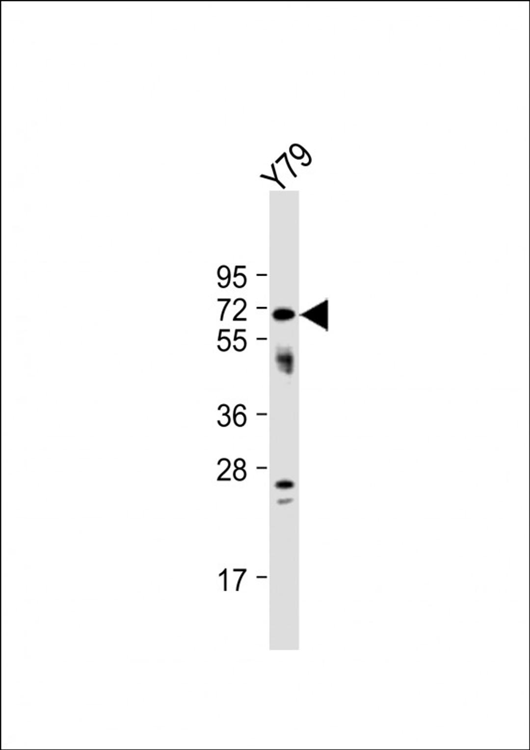 Western Blot at 1:1000 dilution + Y79 whole cell lysate Lysates/proteins at 20 ug per lane.