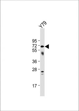 Western Blot at 1:1000 dilution + Y79 whole cell lysate Lysates/proteins at 20 ug per lane.