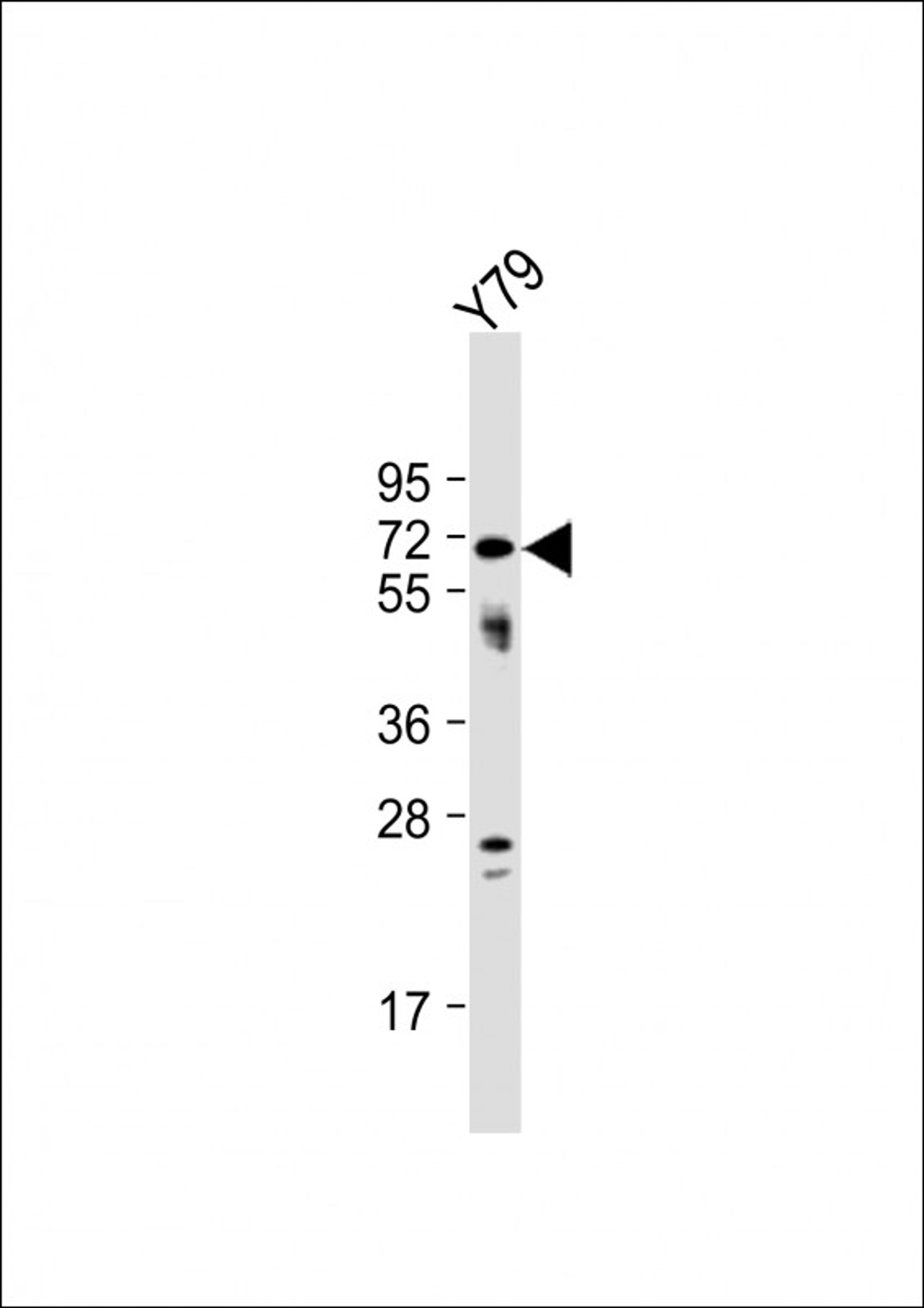 Western Blot at 1:1000 dilution + Y79 whole cell lysate Lysates/proteins at 20 ug per lane.