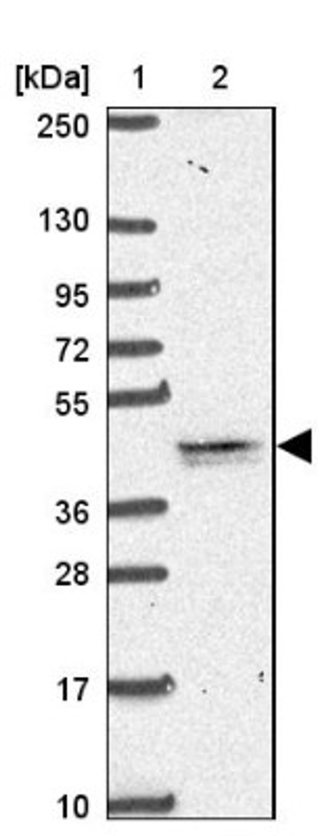 Western Blot: TMEM79 Antibody [NBP2-47601] - Lane 1: Marker [kDa] 250, 130, 95, 72, 55, 36, 28, 17, 10.  Lane 2: Human cell line RT-4