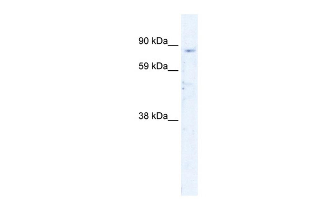 Antibody used in WB on Human Thymus at 0.5 ug/ml.