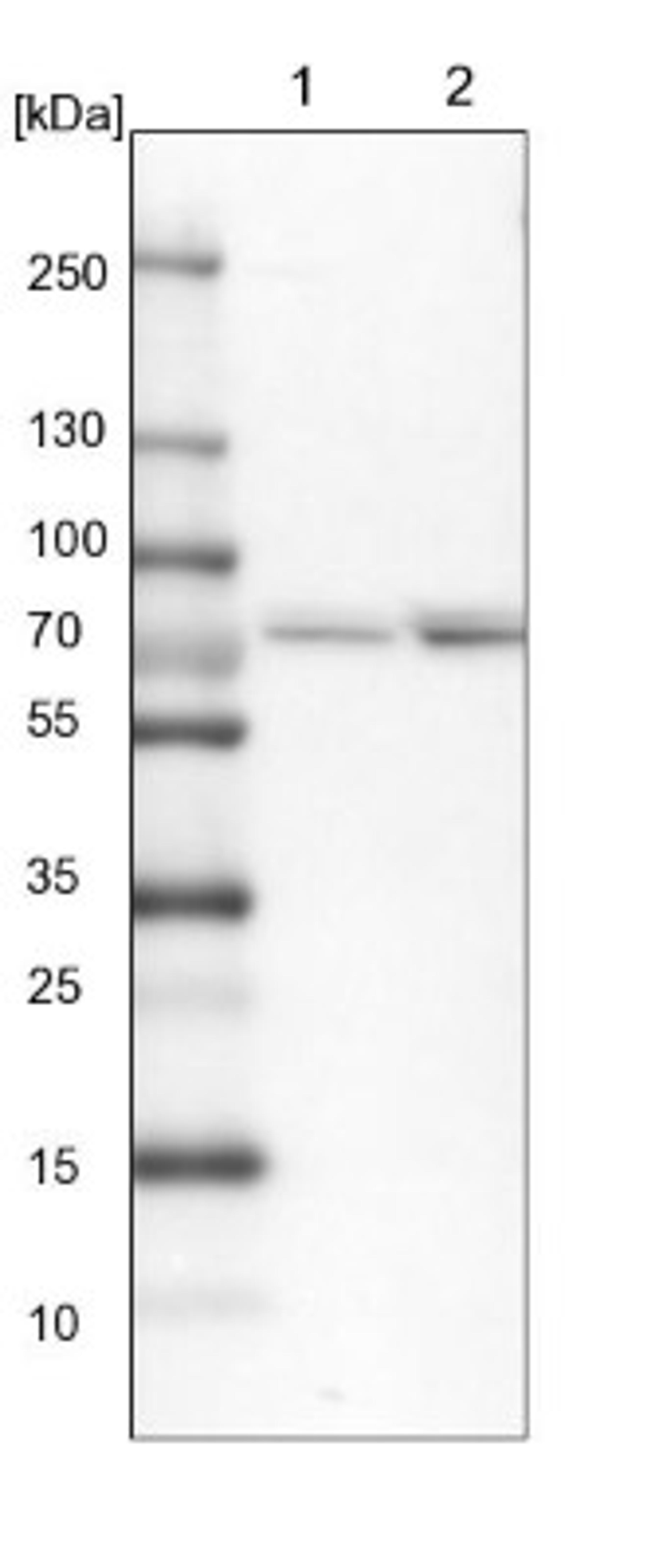 Western Blot: Aminopeptidase P1/XPNPEP1 Antibody [NBP1-80613] - Lane 1: NIH-3T3 cell lysate (Mouse embryonic fibroblast cells)<br/>Lane 2: NBT-II cell lysate (Rat Wistar bladder tumour cells)