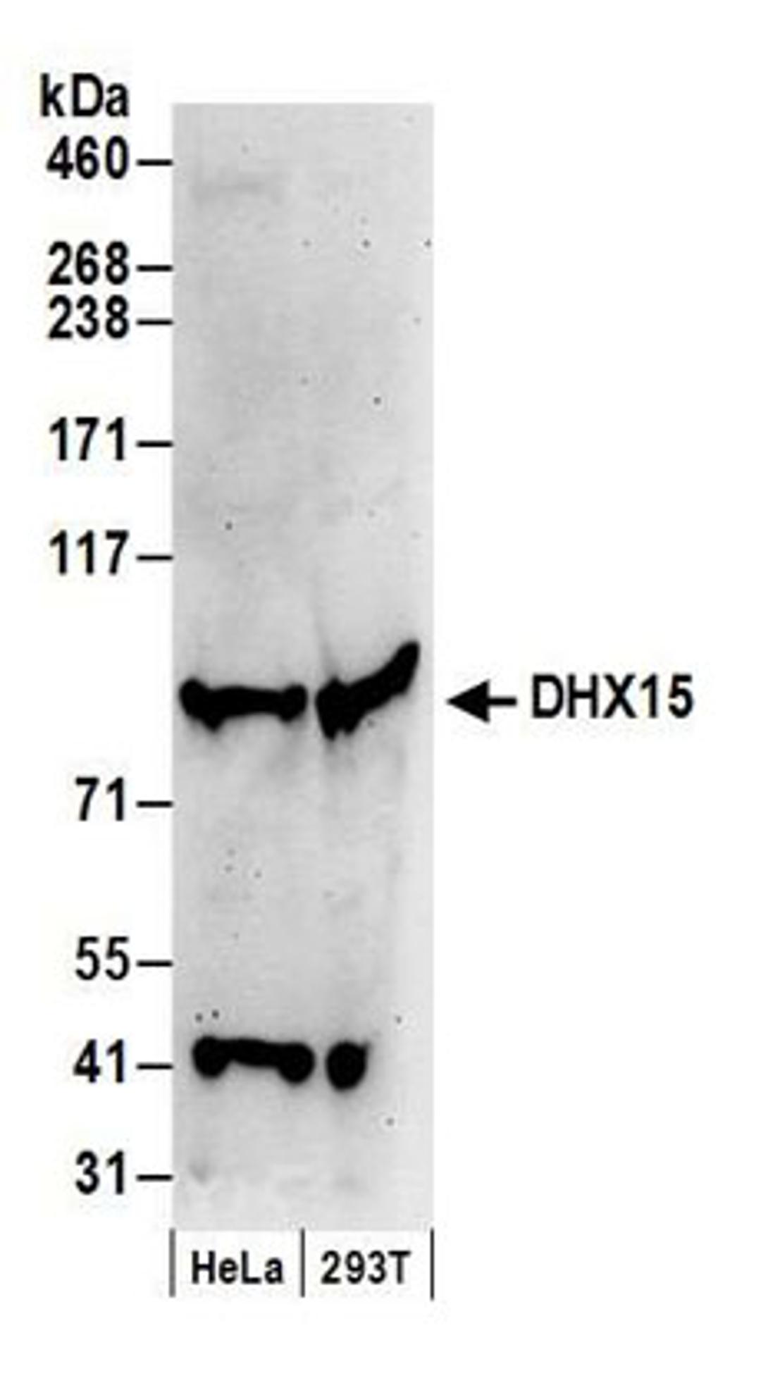 Detection of human DHX15 by western blot.