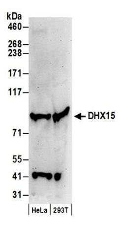 Detection of human DHX15 by western blot.