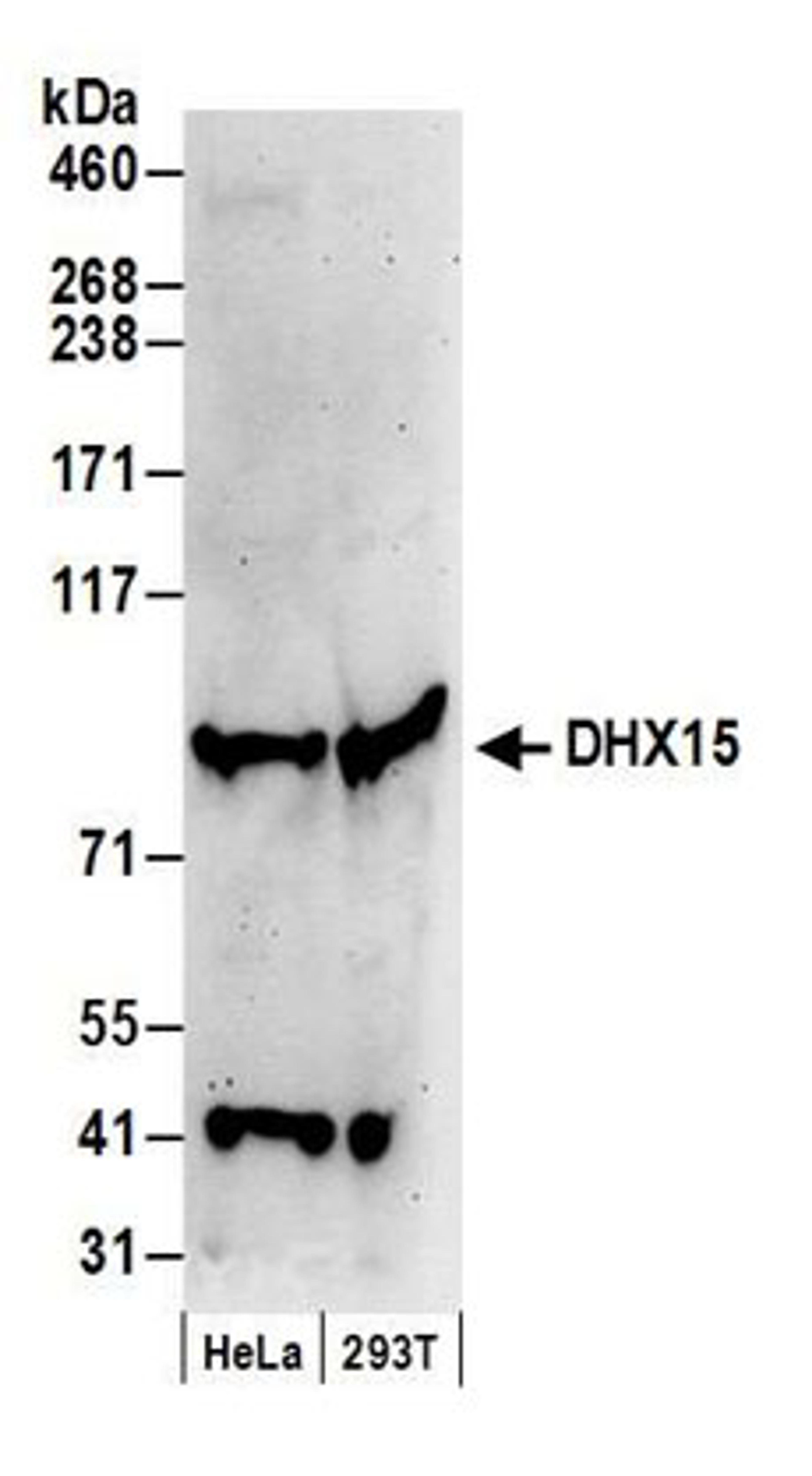 Detection of human DHX15 by western blot.