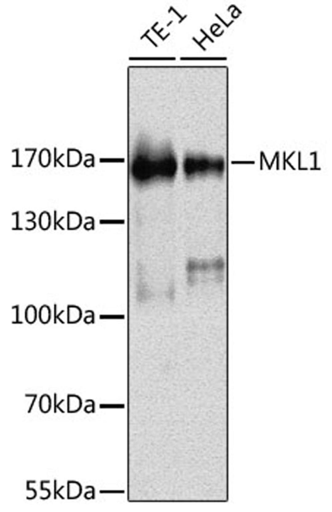 Western blot - MKL1 antibody (A12598)