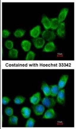 Immunocytochemistry/Immunofluorescence: Galectin-1 Antibody [NBP2-16581] - A431.